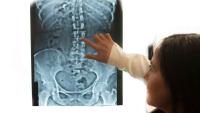A doctor pointing at a spinal X-ray during a medical imaging review.