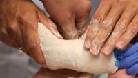 Doctors and nurses putting a cast on the leg of a young child