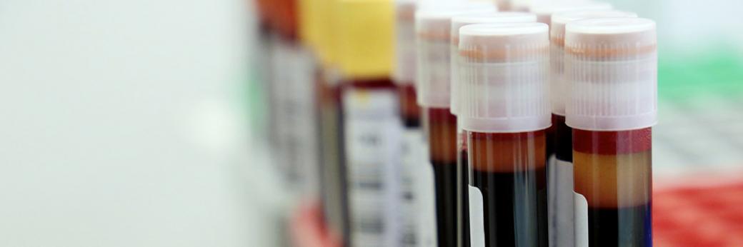 Pediatric Laboratory Services Midtown NYC | ColumbiaDoctors