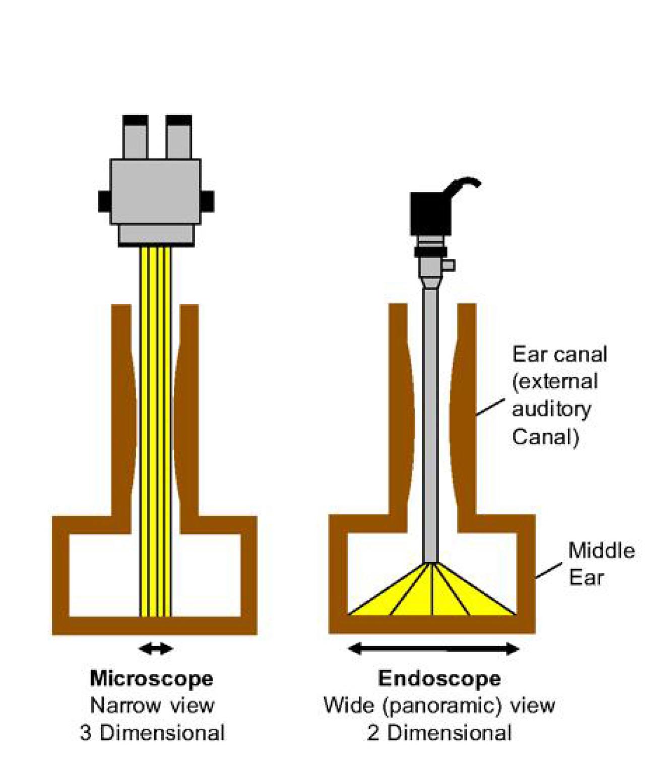 Endoscopic Ear Surgery NYC | ColumbiaDoctors