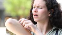 Woman scratches bug bite on her arm.
