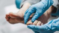 Dermatologist looking at patient's toe nails