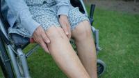 A person in a wheelchair rests their hands on their knees, which show surgical scars.